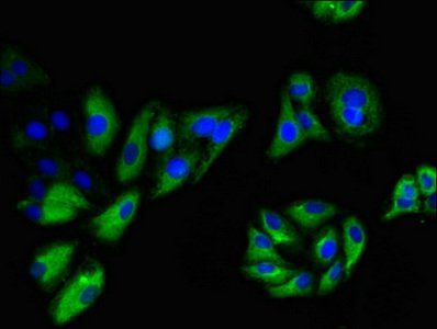 NINJ1 Antibody