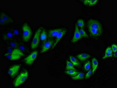 NINJ1 antibody