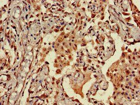 NINJ1 antibody