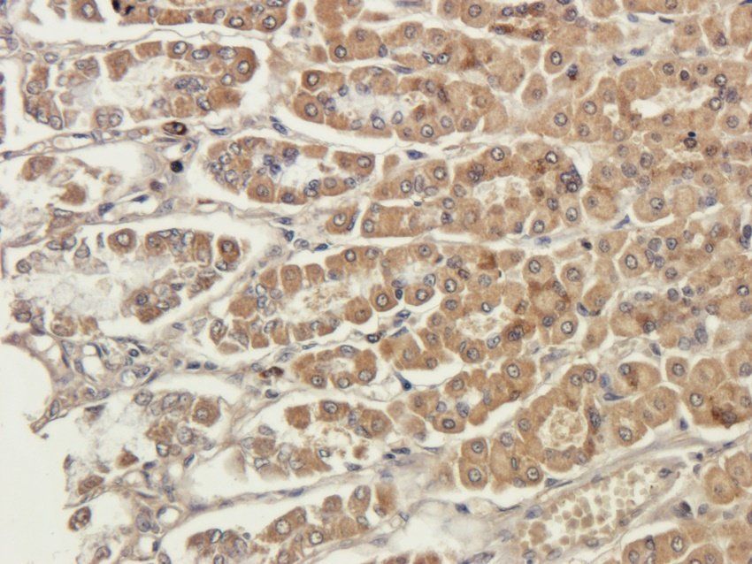 NINJ1 antibody