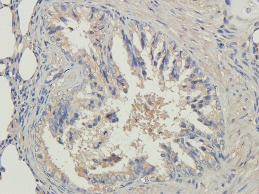 NINJ1 antibody