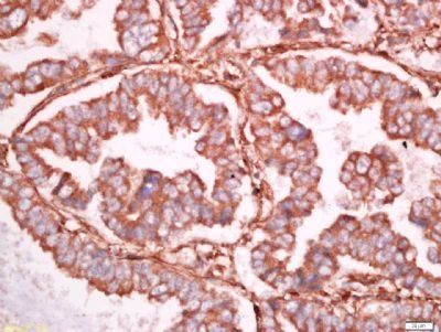 Ninjurin 1 Rabbit Polyclonal Antibody