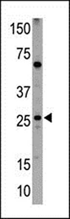 NIP1 antibody