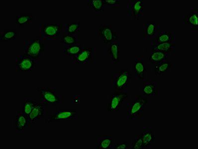 NIP7 antibody