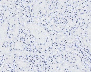 Goat anti-NIPBL (aa889-902) Antibody