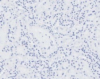 NIPBL antibody