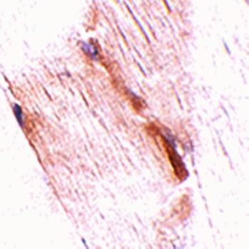 NIPSNAP2 Antibody