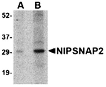 NIPSNAP2 Antibody