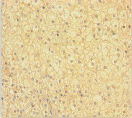 NIPSNAP3B Antibody