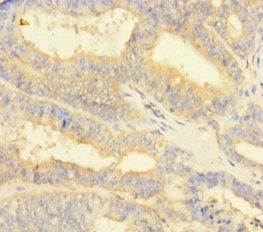 NIPSNAP3B Antibody