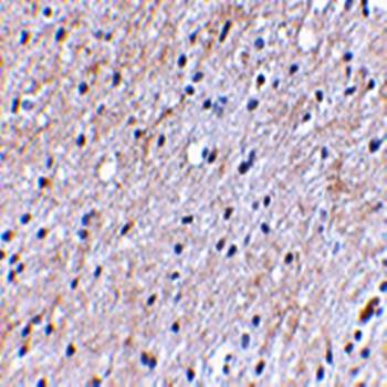 NIPSNAP Rabbit Polyclonal Antibody