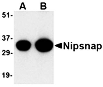 NIPSNAP Rabbit Polyclonal Antibody