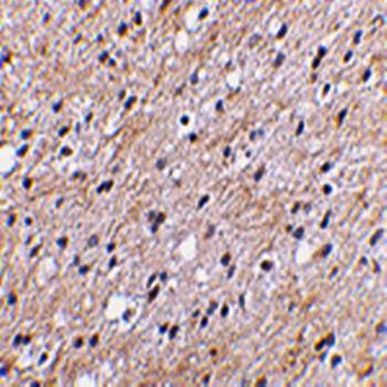 NIPSNAP Rabbit Polyclonal Antibody