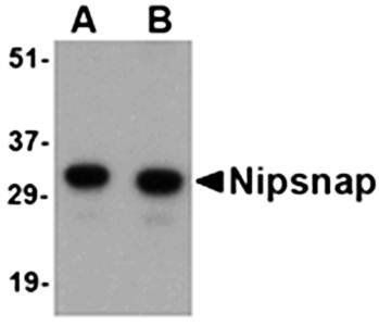 NIPSNAP Rabbit Polyclonal Antibody
