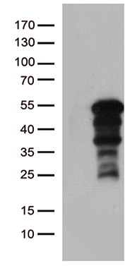 UHRF2 Antibody