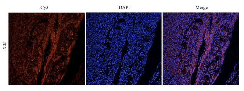 NIS antibody