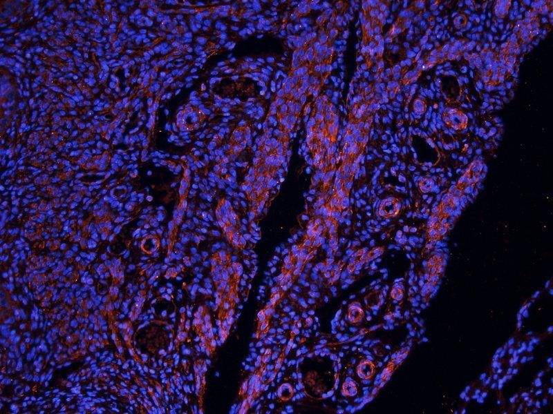 NIS antibody