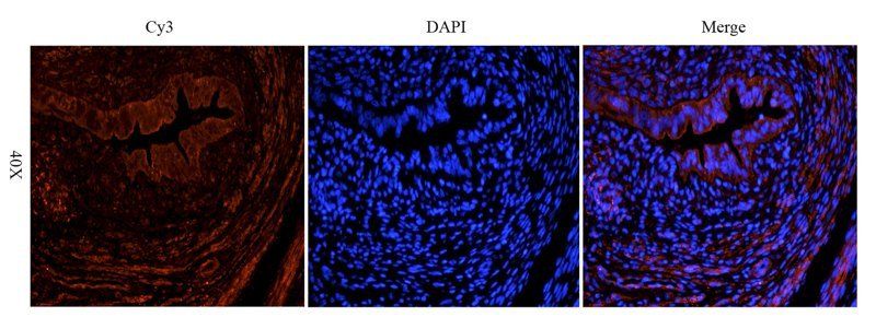 NIS antibody