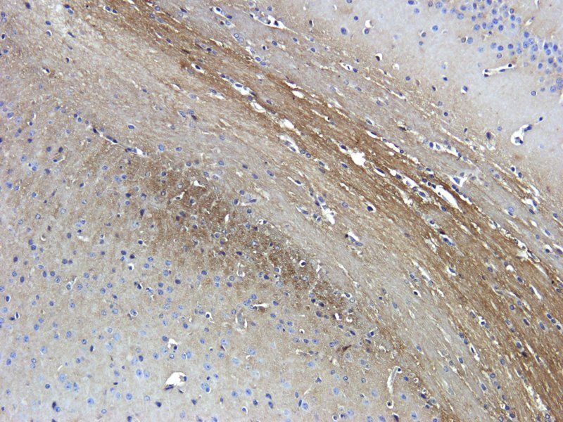 NIS antibody