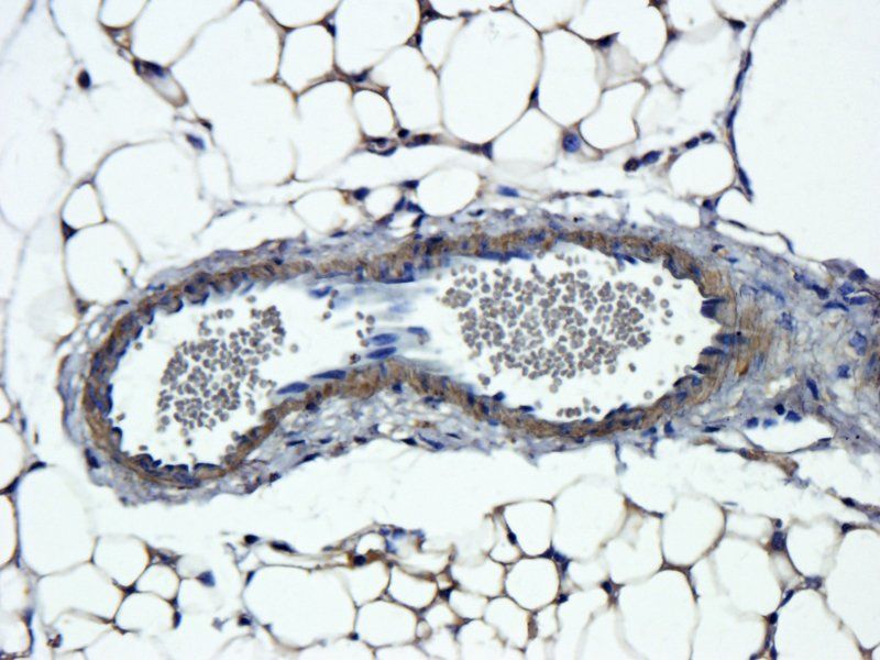 NIS antibody