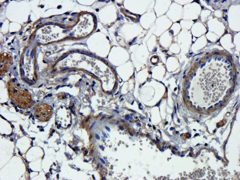 NIS antibody