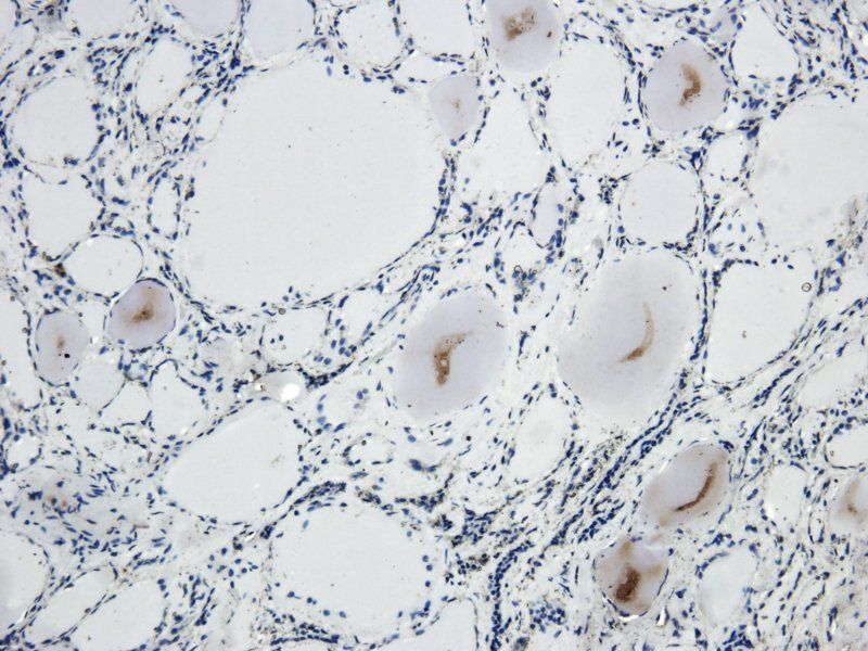 NIS antibody