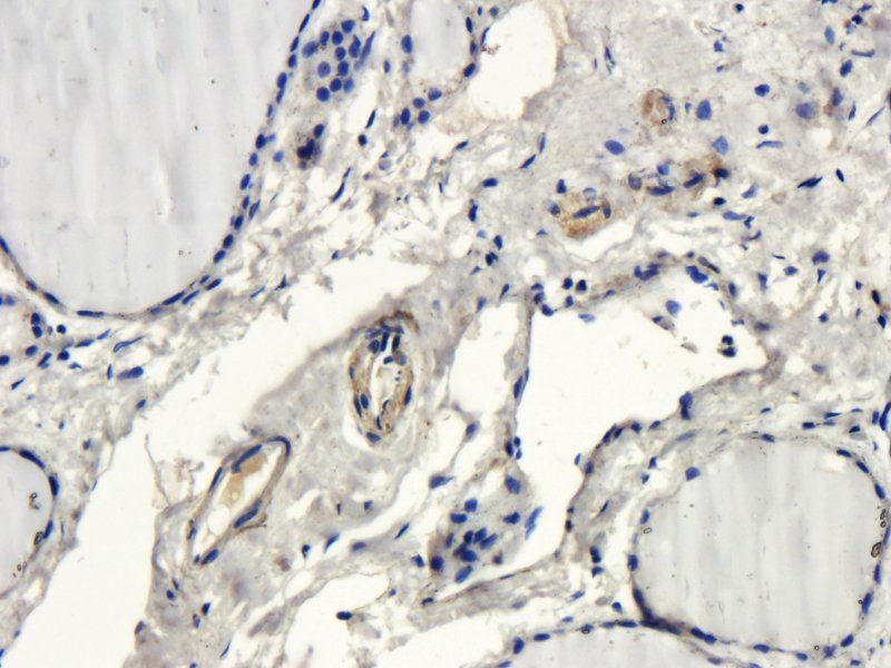 NIS antibody