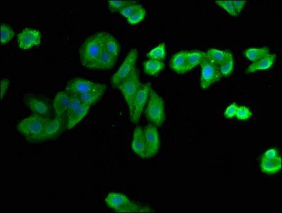NIT1 Antibody