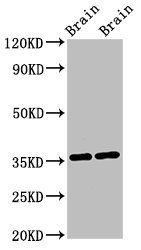 NIT1 Antibody