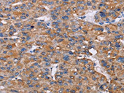 NIT1 Antibody