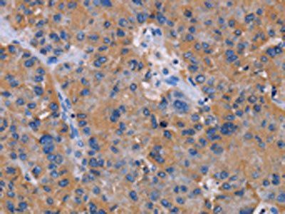 NIT1 Antibody