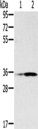 NIT1 Antibody