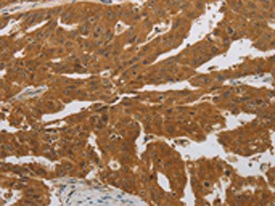 NIT2 Antibody