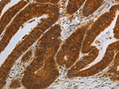 NIT2 Antibody