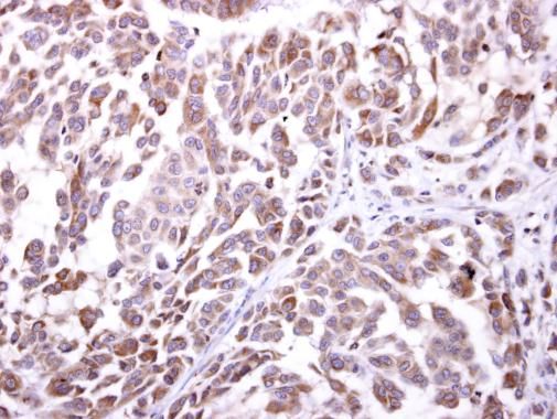 NKG2D Rabbit Polyclonal Antibody