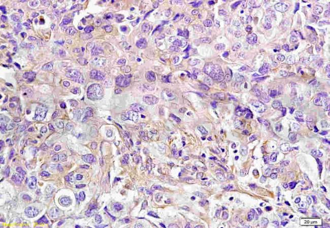 NCR2 Rabbit Polyclonal Antibody
