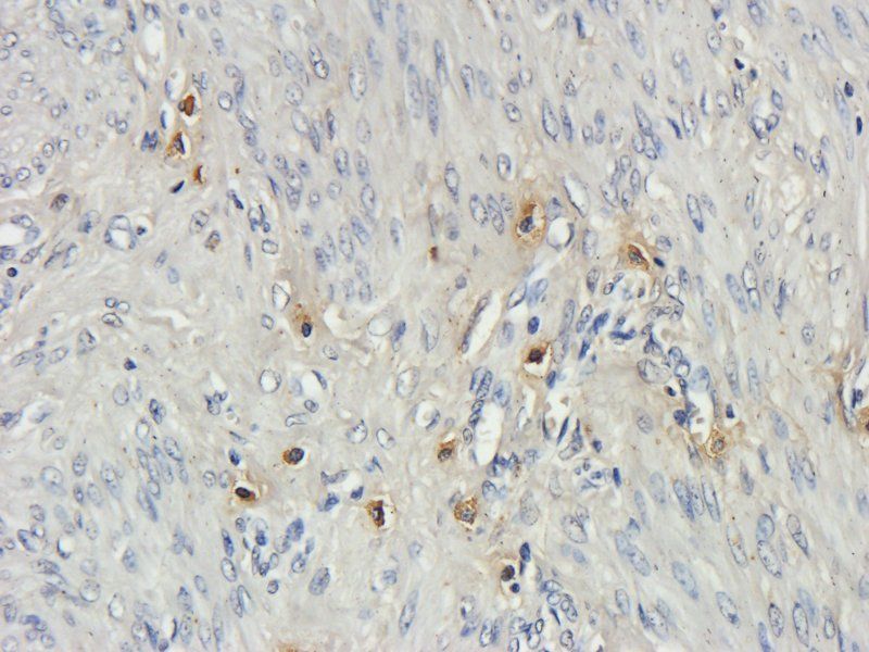 NKp44 antibody