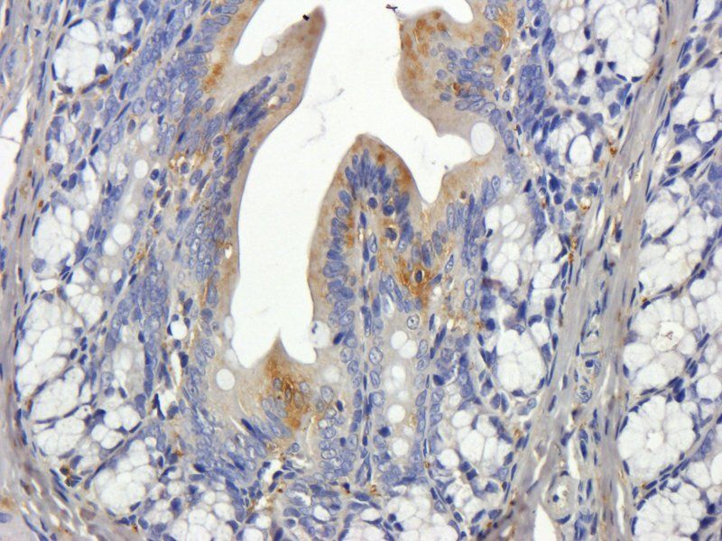 NKp44 antibody