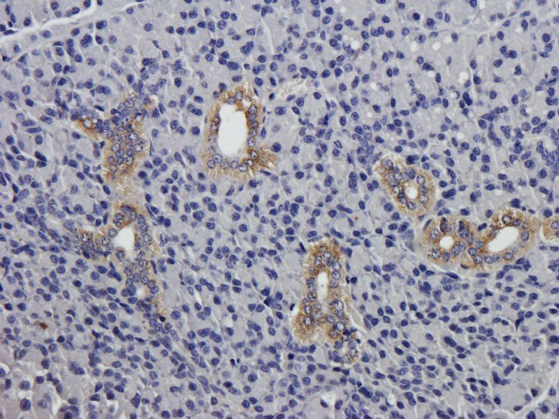 NKp44 antibody