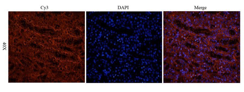 NKp46 antibody