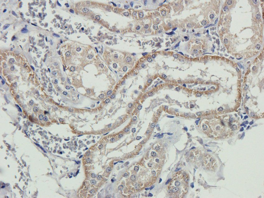 NKp46 antibody