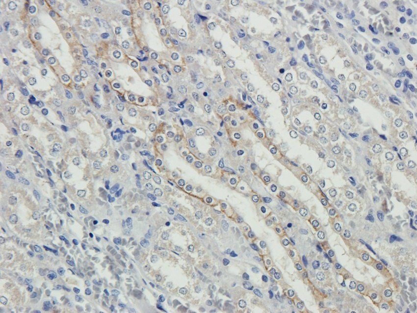 NKp46 antibody