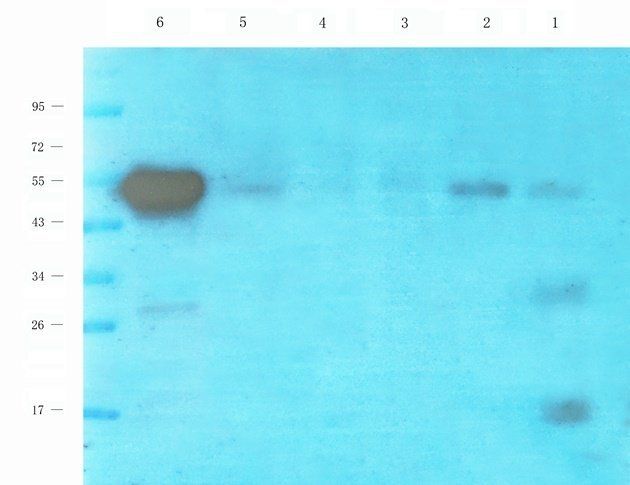 NKp46 antibody