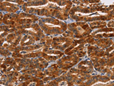 NKp46 antibody