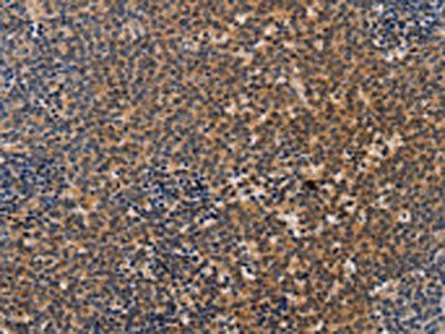 NCR1 Antibody
