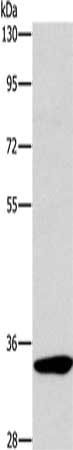 NKp46 antibody