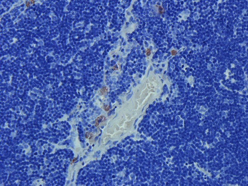 NKp46 antibody