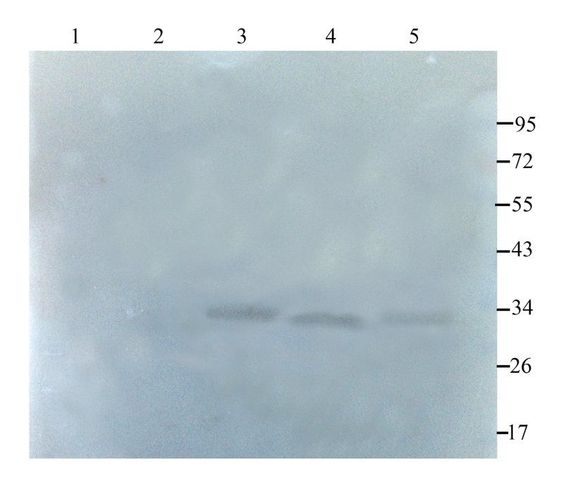 NKp46 antibody