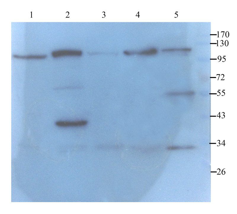 NKp46 antibody