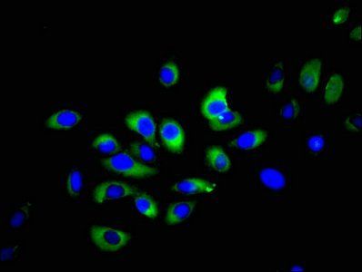 NKp46 antibody